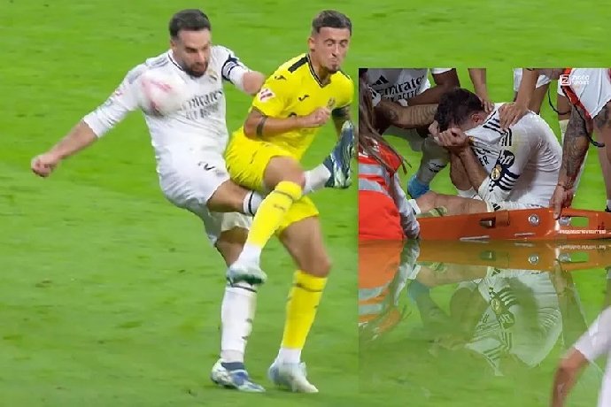 Dani Carvajal dính chấn thương kinh dị, xác định nghỉ hết mùa giải