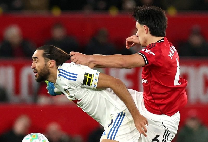 Martinez bị treo giò bao nhiêu trận sau pha kéo tóc gây tranh cãi? - Ảnh 1