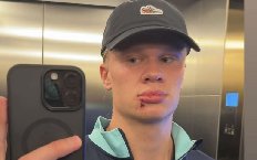 Haaland phải khâu 3 mũi